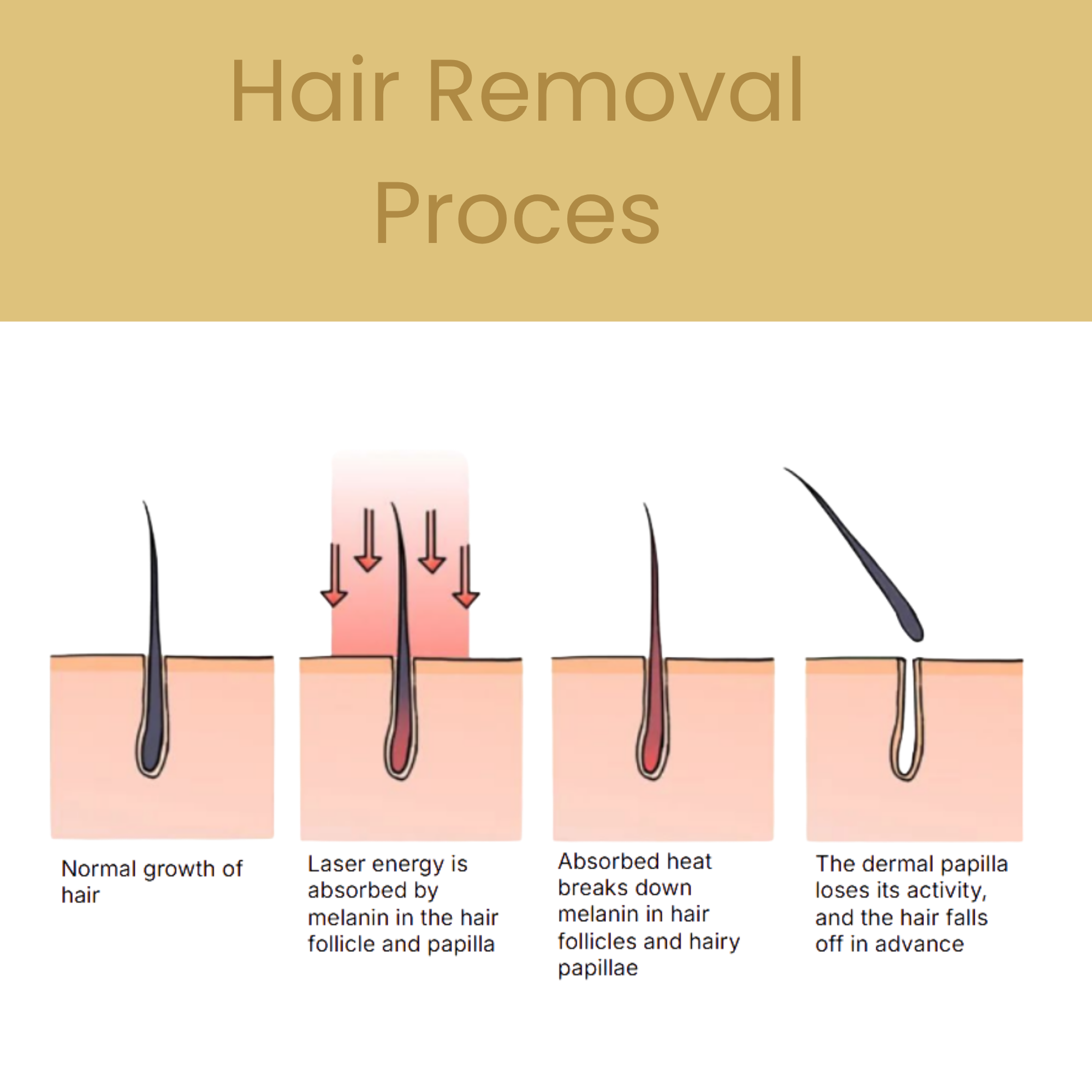 Hair Removal & Skin Rejuvenation Device